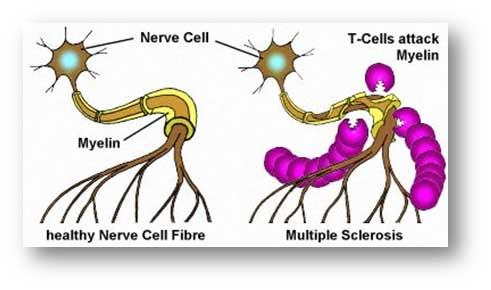 Nerve cell