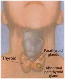 thyorid